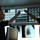 Dr. Krüll und Dr. Noga vor Röntgenbildern