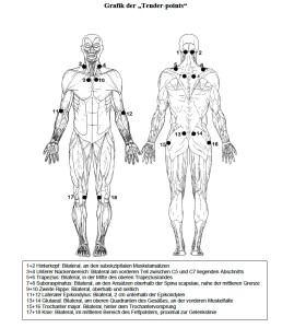 Die Tender Points